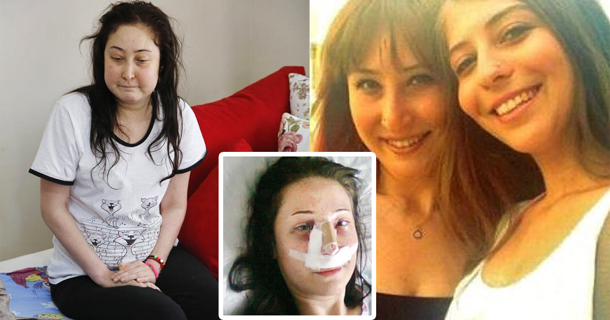 Woman loses her legs after undergoing nose job