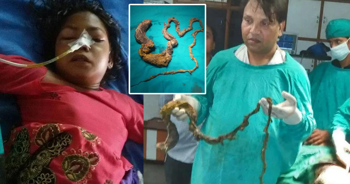 Some of the most amazing finds inside an Indian woman's body