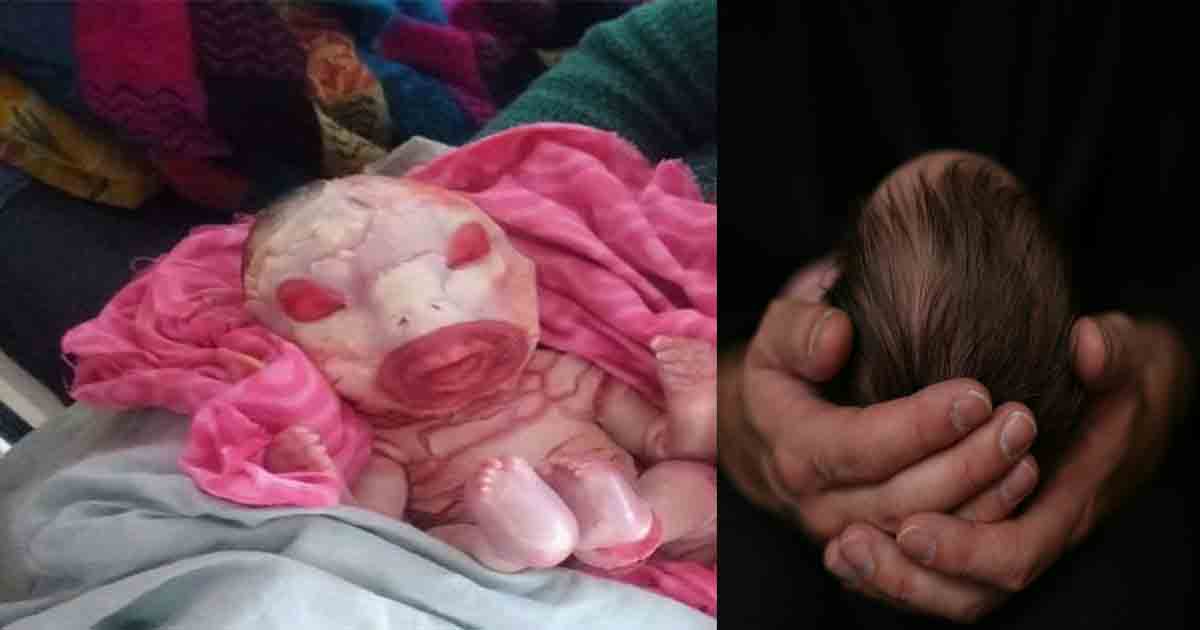 Strange baby born in this hospital in Bihar