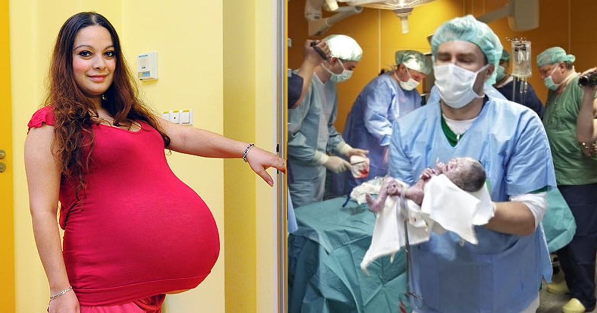 Czech Republic quintuplets