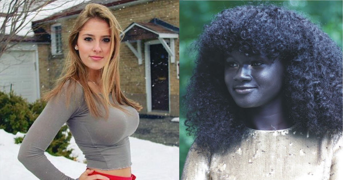 People With Rare And Unique Beauty