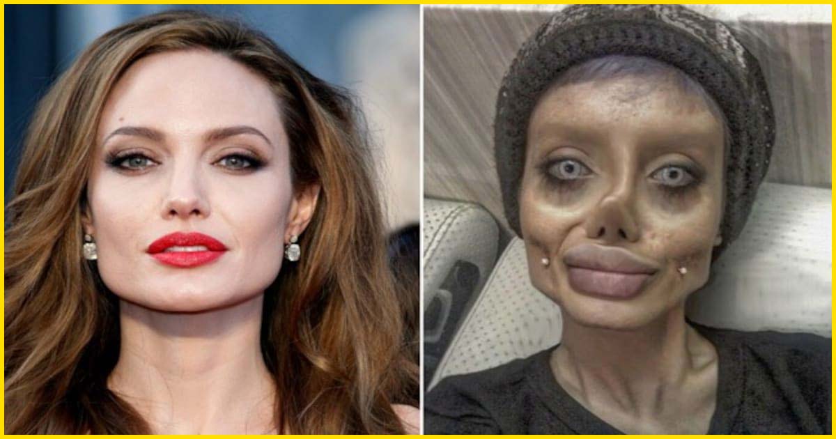 Plastic surgery fails