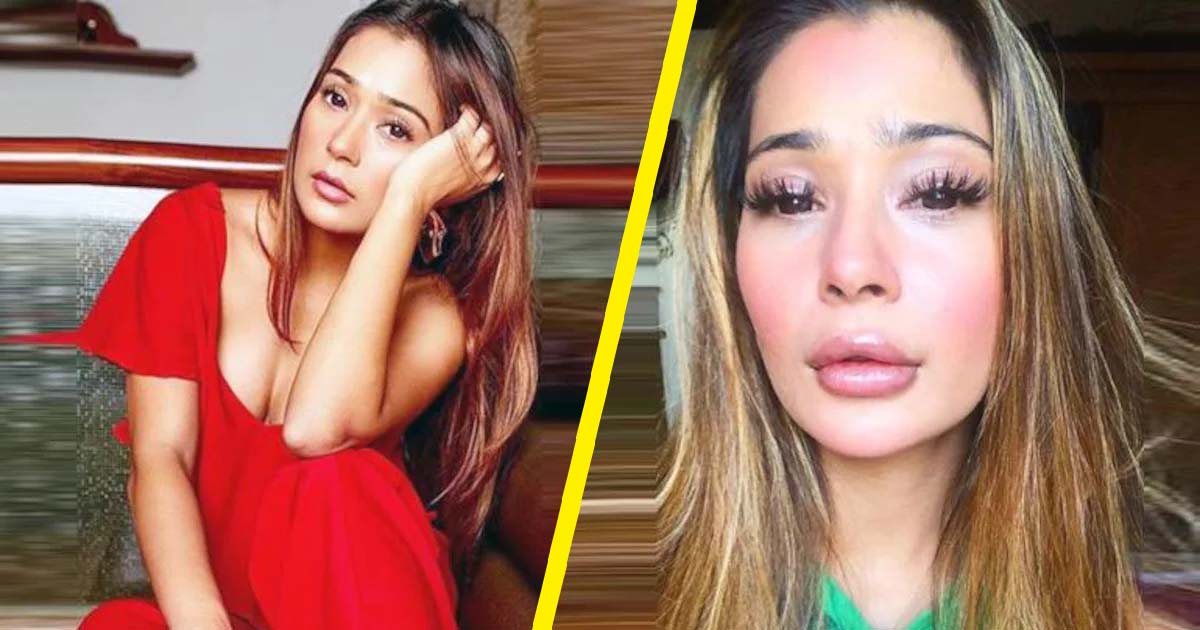 Sara Khan's lip gone wrong