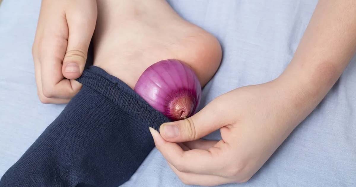 Onion in Foot