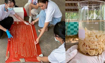 Meter Long Worm Removed from Thai Mans Body