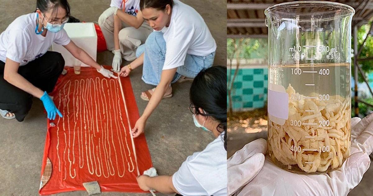 Meter Long Worm Removed from Thai Mans Body