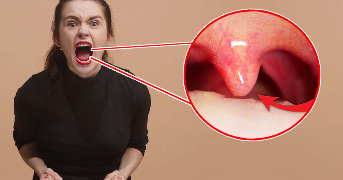 Uvula