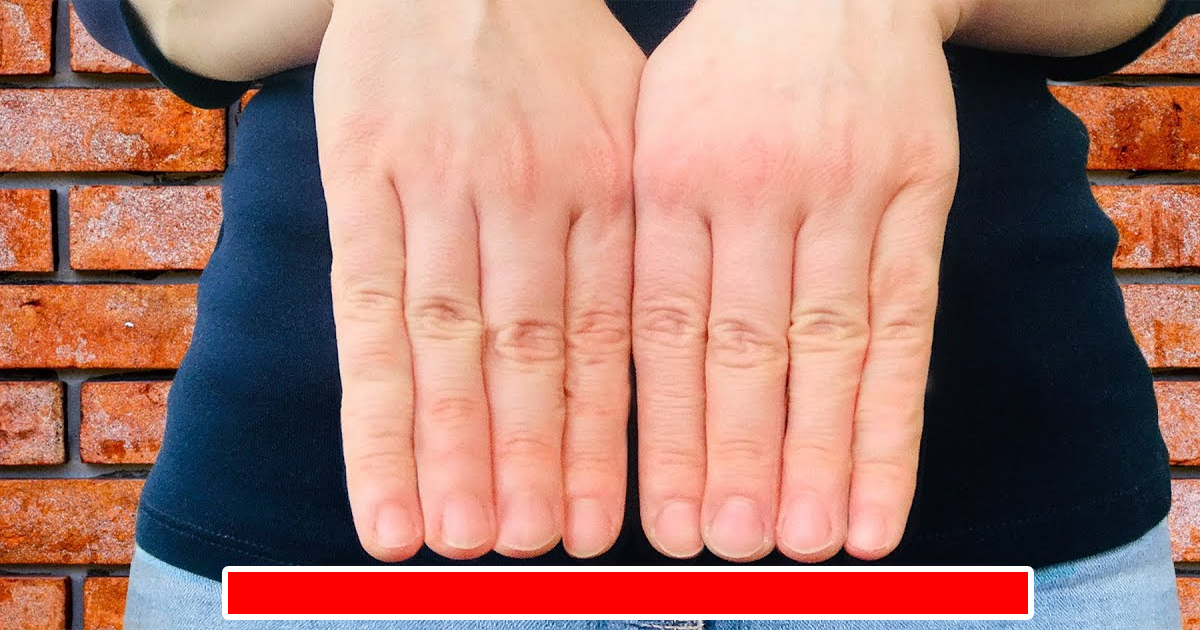 Why Are Your Fingers Different Sizes