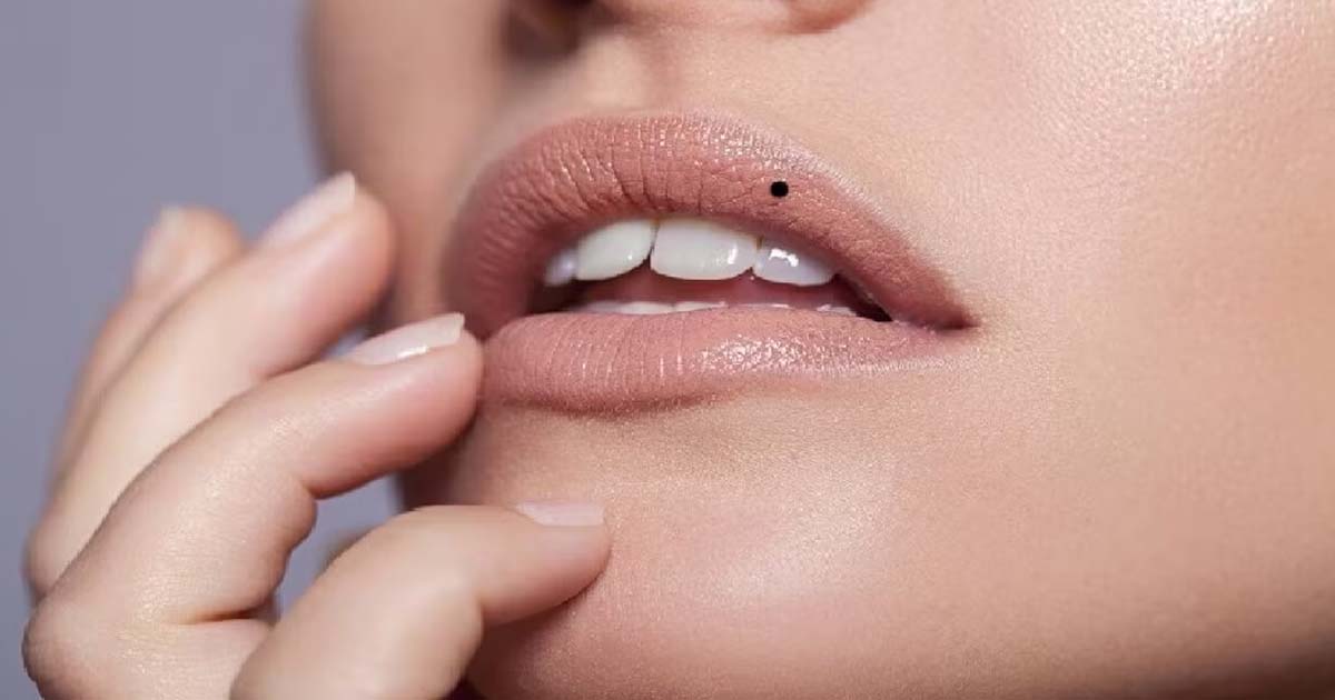 Moles on Lip