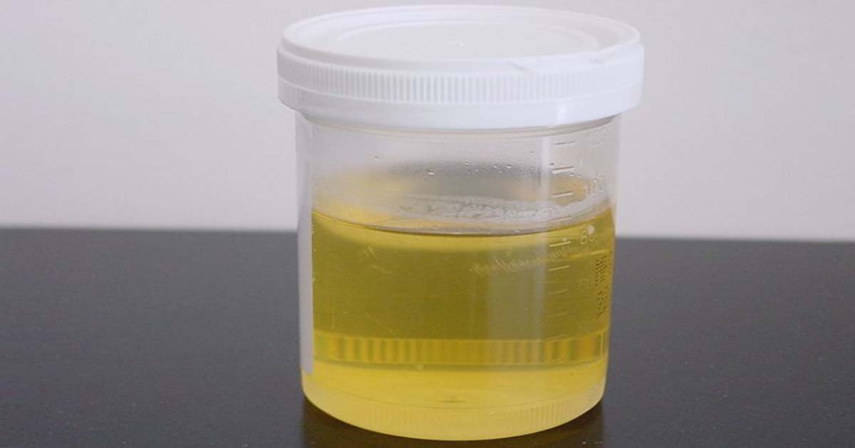 Urine