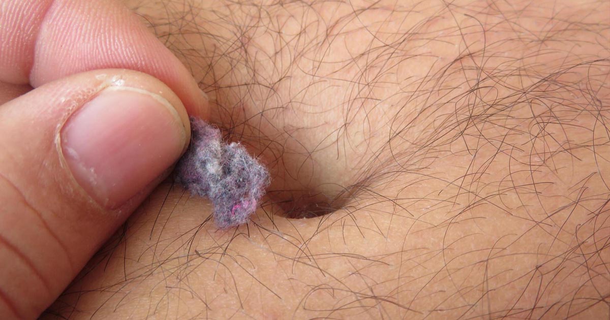 Why cotton like material are found in navel